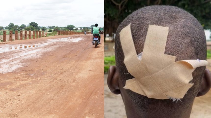 How Ghanas debt crisis is causing nightmares and injuries on Bolgatanga Bawku road