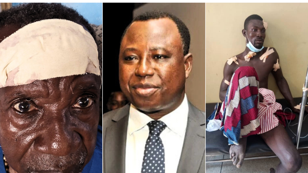 From left to Right: Djinyami Alimo, in his late 70s, who suffered a severe forehead injury during the 2022 police attack at Toflokpo; Joseph Whittal, Commissioner of CHRAJ; and Sampon Agboveh, who sustained multiple gunshot wounds in the 2021 assault involving Electrochem security and police.
